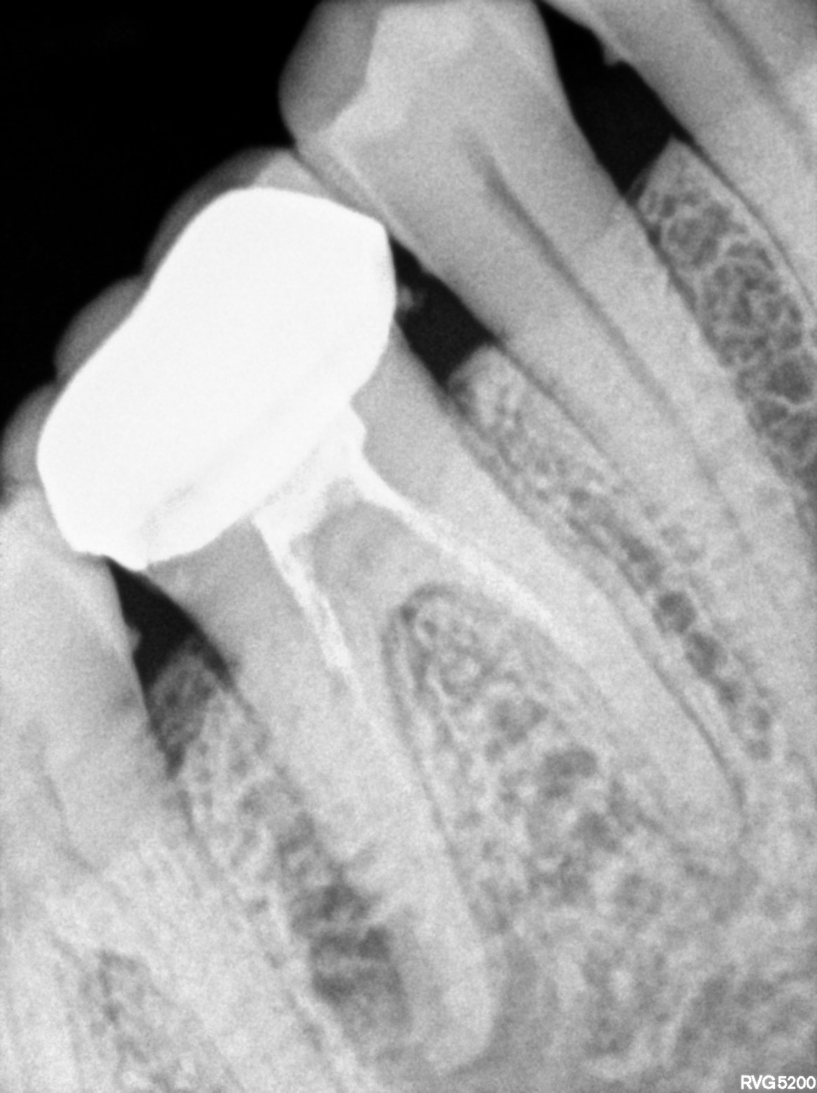 Dental X-ray